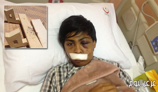 نجاة شاب بعد أن سقط به أحد الكراسي الأسمنتية بممشى حي المنصورية بعرعر